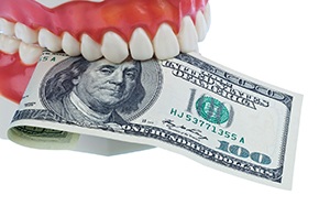 Dental mold biting $100 bill