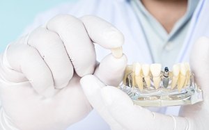 Dentist holding a crown of a dental implant
