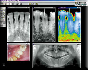 digital x-rays