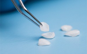 closeup of veneers on table  