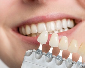 Shades of dental veneers being held next to patient's teeth