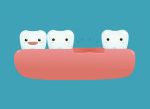 cartoon concept artwork showing a gap between teeth